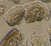 Gut cells